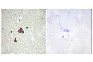 Immunohistochemistry (IHC) image for anti-Adenylate Cyclase 8 (Brain) (ADCY8) (Internal Region) antibody (ABIN1850180) (ADCY8 抗体  (Internal Region))
