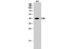 Western Blotting (WB) image for anti-Secreted phosphoprotein 1 (SPP1) (C-Term) antibody (ABIN3186218) (Osteopontin 抗体  (C-Term))