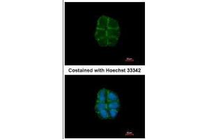 ICC/IF Image Immunofluorescence analysis of paraformaldehyde-fixed A431, using Desmoglein 2, antibody at 1:500 dilution. (Desmoglein 2 抗体  (N-Term))