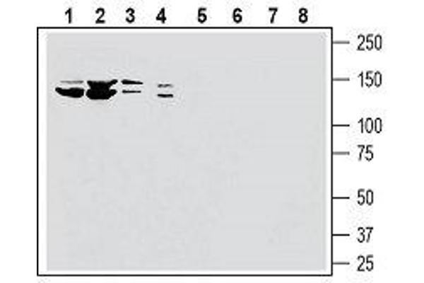 SLC28A3 抗体  (5th Extracellular Loop)