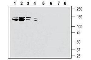 Western blot analysis of human HL-60 myelocytic leukemia cell line lysate (lanes 1 and 5), human K562 chronic myelogenous leukemia cell line lysate (lanes 2 and 6), human MCF-7 breast adenocarcinoma cell line lysate (lanes 3 and 7) and human PANC-1 pancreatic carcinoma cell line lysate (lanes 4 and 8): - 1-4. (SLC28A3 抗体  (5th Extracellular Loop))