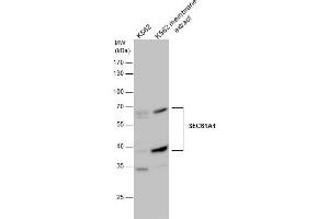 WB Image SEC61A1 antibody detects SEC61A1 protein by western blot analysis.