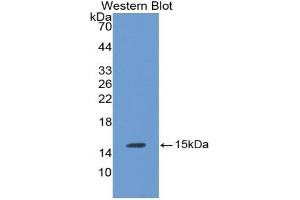 Detection of Recombinant LHb, Rat using Monoclonal Antibody to Luteinizing Hormone Beta Polypeptide (LHb) (LHB 抗体  (AA 21-141))