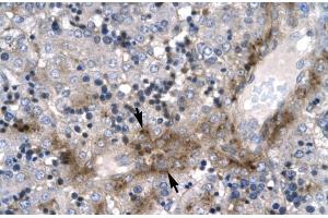 Human Liver; Rabbit Anti-ZNF365 Antibody. (ZNF365 抗体  (N-Term))