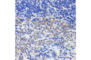 Immunohistochemistry (IHC) image for anti-ATG7 Autophagy Related 7 (ATG7) antibody (ABIN7265711)