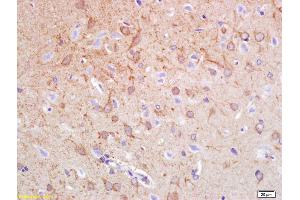 Formalin-fixed and paraffin embedded rat brain labeled with Anti-Synphilin-1 Polyclonal Antibody, Unconjugated (ABIN736163) at 1:200 followed by conjugation to the secondary antibody and DAB staining. (SNCAIP 抗体  (AA 51-150))