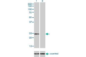 Western blot analysis of AK1 over-expressed 293 cell line, cotransfected with AK1 Validated Chimera RNAi (Lane 2) or non-transfected control (Lane 1). (Adenylate Kinase 1 抗体  (AA 1-194))