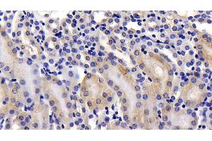 Immunohistochemistry (IHC) image for anti-ATG7 Autophagy Related 7 (ATG7) (AA 477-698) antibody (ABIN7441640)