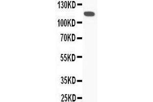 Western Blotting (WB) image for anti-Complement Component 5 (C5) (AA 1-18), (N-Term) antibody (ABIN3044294) (C5 抗体  (N-Term))