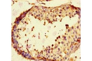 Immunohistochemistry of paraffin-embedded human testis tissue using ABIN7169195 at dilution of 1:100 (TBK1 抗体  (AA 364-585))