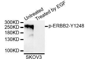 Western blot analysis of extracts of SKOV3 cell line, using Phospho-ERBB2-Y1248 antibody (ABIN5995620). (ErbB2/Her2 抗体  (pTyr1248))