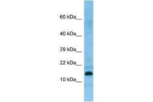 WB Suggested Anti-PRH2 Antibody Titration: 1. (PROC 抗体  (N-Term))