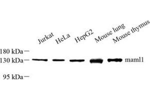 Western blot analysis of maml1 (ABIN7074560) at dilution of 1: 500 (MAML1 抗体)