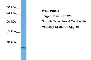 Host: Rabbit Target Name: SRRM2 Sample Tissue: Human Jurkat Whole Cell Antibody Dilution: 1ug/ml (SRRM2 抗体  (C-Term))