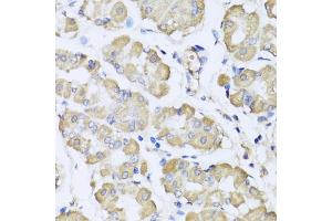 Immunohistochemistry of paraffin-embedded human stomach using L2HGDH antibody (ABIN5975242) at dilution of 1/100 (40x lens). (L2HGDH 抗体)