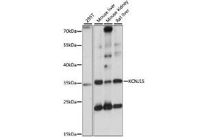 Western blot analysis of extracts of various cell lines, using KCNJ15 antibody.