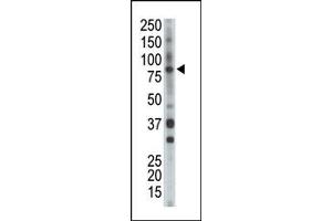 Image no. 1 for anti-BMX Non-Receptor Tyrosine Kinase (BMX) (Middle Region) antibody (ABIN359973) (BMX 抗体  (Middle Region))