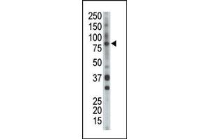 Image no. 1 for anti-BMX Non-Receptor Tyrosine Kinase (BMX) (Middle Region) antibody (ABIN359973)