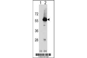 Western blot analysis of Stk3 using rabbit polyclonal Mouse Stk3 Antibody using 293 cell lysates (2 ug/lane) either nontransfected (Lane 1) or transiently transfected (Lane 2) with the Stk3 gene. (STK3 抗体  (C-Term))