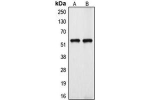Western blot analysis of Cytochrome P450 39A1 expression in HeLa (A), HuvEc (B) whole cell lysates. (CYP39A1 抗体  (Center))