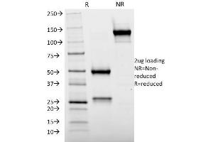 SDS-PAGE Analysis Purified Cytochrome p450 Mouse Monoclonal Antibody (M12P4H2). (CYP2E1 抗体  (C-Term))