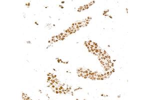 Immunocytochemistry (ICC) image for anti-Androgen Receptor (AR) (AA 1-50) antibody (ABIN7795785)