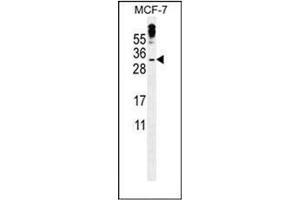 Western blot analysis of MBD3L3 Antibody (C-term) in MCF-7 cell line lysates (35ug/lane). (MBD3L3 抗体  (C-Term))