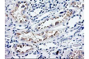 Immunohistochemistry (IHC) image for anti-Cyclin-Dependent Kinase Inhibitor 3 (CDKN3) antibody (ABIN1497459) (CDKN3 抗体)