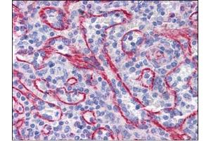 Human Spleen: Formalin-Fixed, Paraffin-Embedded (FFPE) (STAU1/Staufen 抗体  (C-Term))