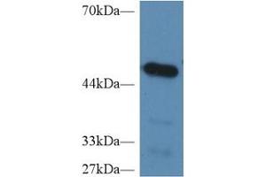 Western Blotting (WB) image for Carboxypeptidase B2 (Plasma) (CPB2) ELISA Kit (ABIN6574177)