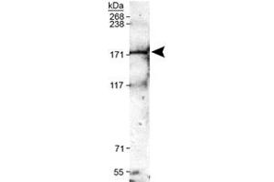 Western blot analysis of Trpm2 in mouse brain membrane lysates with Trpm2 polyclonal antibody . (TRPM2 抗体  (AA 1200-1300))