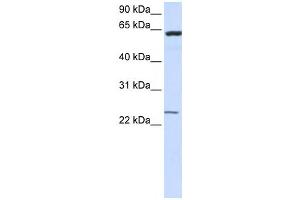 Western Blotting (WB) image for anti-Transmembrane Protein 138 (TMEM138) antibody (ABIN2459085) (TMEM138 抗体)