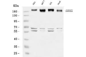 Western blot analysis of HER2/ERBB2 using anti-HER2/ERBB2 antibody (ABIN7602717).