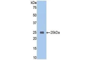 Detection of Recombinant TAFI, Mouse using Polyclonal Antibody to Carboxypeptidase B2 (CPB2) (CPB2 抗体  (AA 187-327))
