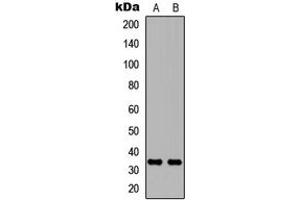 Western blot analysis of Carbonic Anhydrase 8 expression in MCF7 (A), NS-1 (B) whole cell lysates. (CA8 抗体  (Center))
