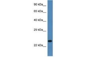 Image no. 1 for anti-Signal Sequence Receptor, beta (Translocon-Associated Protein Beta) (SSR2) (AA 99-148) antibody (ABIN6746258)