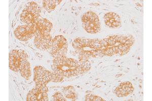 Immunohistochemistry (IHC) image for anti-Mitogen-Activated Protein Kinase Kinase 2 (MAP2K2) (AA 1-50) antibody (ABIN7454013) (Recombinant MEK2 抗体  (AA 1-50))
