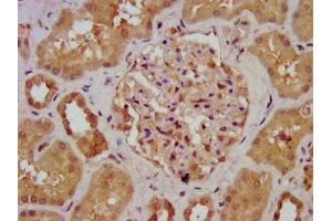 IHC image of ABIN7143624 diluted at 1:700 and staining in paraffin-embedded human kidney tissue performed on a Leica BondTM system. (AGXT2 抗体  (AA 196-328))