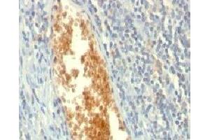 Formalin-fixed, paraffin-embedded human tonsil stained with AMPD3 antibody (AMPD3/901) (AMPD3 抗体)