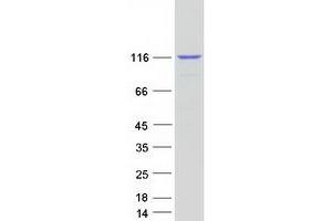 Western Blotting (WB) image for RAS P21 Protein Activator (GTPase Activating Protein) 1 (RASA1) (Transcript Variant 1) protein (Myc-DYKDDDDK Tag) (ABIN2730523)