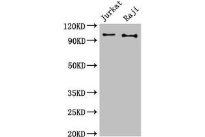 Western Blot Positive WB detected in: Jurkat whole cell lysate, Raji whole cell lysate All lanes: CBL antibody at 3 μg/mL Secondary Goat polyclonal to rabbit IgG at 1/50000 dilution Predicted band size: 100 kDa Observed band size: 100 kDa (CBL 抗体  (AA 548-847))