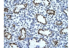 Rabbit Anti-ENO1 Antibody       Paraffin Embedded Tissue:  Human alveolar cell   Cellular Data:  Epithelial cells of renal tubule  Antibody Concentration:   4. (ENO1 抗体  (C-Term))