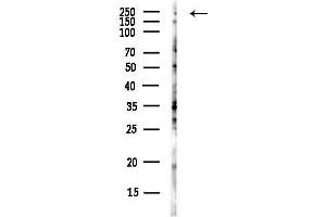 anti-Cytoskeleton Associated Protein 5 (CKAP5) antibody