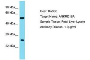 Image no. 1 for anti-Ankyrin Repeat Domain 18A (ANKRD18A) (AA 781-830) antibody (ABIN6750781) (ANKRD18A 抗体  (AA 781-830))