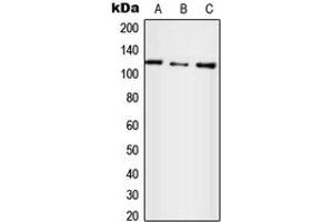 Western blot analysis of UBE4A expression in HepG2 (A), SP2/0 (B), H9C2 (C) whole cell lysates. (UBE4A 抗体  (N-Term))