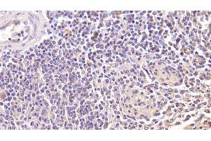 Immunohistochemistry (IHC) image for anti-Killer Cell Lectin-Like Receptor Subfamily K, Member 1 (KLRK1) (AA 92-216) antibody (ABIN7428548)