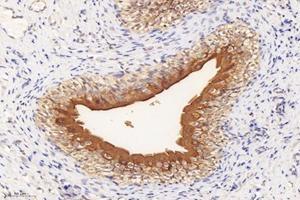 Immunohistochemistry analysis of paraffin-embedded rat bladder using,Uroplakin Ia (ABIN7076160) at dilution of 1: 4000 (UPK1A 抗体)