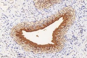 Immunohistochemistry analysis of paraffin-embedded rat bladder using,Uroplakin Ia (ABIN7076160) at dilution of 1: 4000 (UPK1A 抗体)