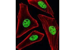 Fluorescent image of Hela cells stained with SP1 Antibody (ABIN1944791 and ABIN2838536). (SP1 抗体  (AA 1-250))