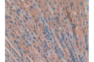 Used in DAB staining on fromalin fixed paraffin- embedded brain tissue (ANG 抗体  (AA 25-145))